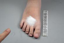 家里有食盐，在脚上抹一抹，别不当回事，早知道就好了，抓紧学学