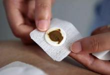 三伏贴为什么会发热放了什么材质的药