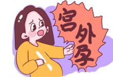 ​为什么会出现宫外孕什么是宫外孕