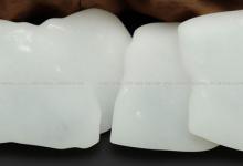 和田白玉虎皮原石籽料