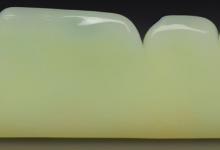 俄料和田玉和白玉