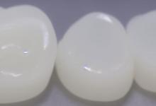 白玉可以戴吗