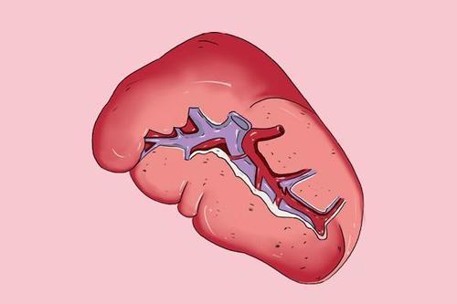 有一条沟,是神经,血管出入之处,称脾门,上缘前部有2-3个切迹,称脾切迹