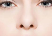 黑头究竟是什么黑头该怎么处理