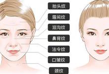 ​皱眉会产生皱纹么皱纹去除的方法有哪些