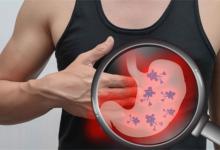 胃胀气时候吃什么胃胀气该吃点什么