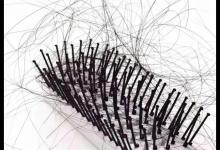 洗发护发7个小妙招缓解掉发不“秃”然