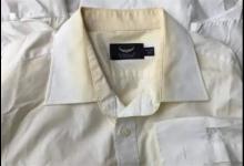 衣服泛黄洗不掉先要了解原因推荐几种超有效的处理方法