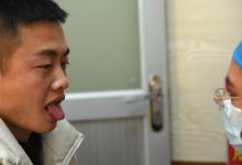 医生看病时为什么要看病人的舌头从舌头可以看出哪些信息
