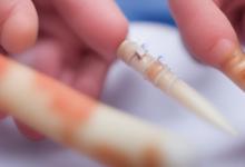 骨穿多长时间出结果