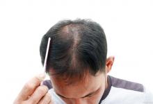 4个日常行为正在偷走你的气血！气血虚、掉头发的人看完赶紧改