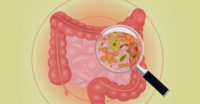 肠道垃圾损健康,彻底清理肠道,试试这些办法_养生保健_中睿百科网